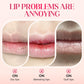📢📢60%  OFF !! ⏰50K+ SOLD!✨Nooni Apple Hydrating Moisturizer Plump Transfer-proof Glossy Lip Stain Oil💋