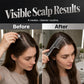 📢📢50% OFF !!⏰ Scalp Applicator Comb Tool for Hair