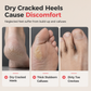 📢📢50% OFF !! ⏰3-in-1 Callus Remover & Foot Scrub – Safe 304 Stainless Steel, Soft Rubber Toe Bristles & Pumice Stone – Smooth Soft Feet in 3 Simple Steps 🔧