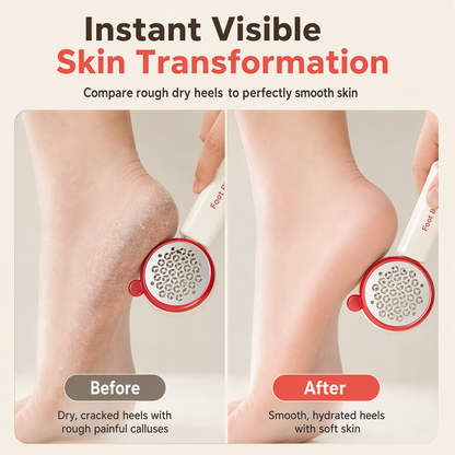 📢📢50% OFF !! ⏰3-in-1 Callus Remover & Foot Scrub – Safe 304 Stainless Steel, Soft Rubber Toe Bristles & Pumice Stone – Smooth Soft Feet in 3 Simple Steps 🔧